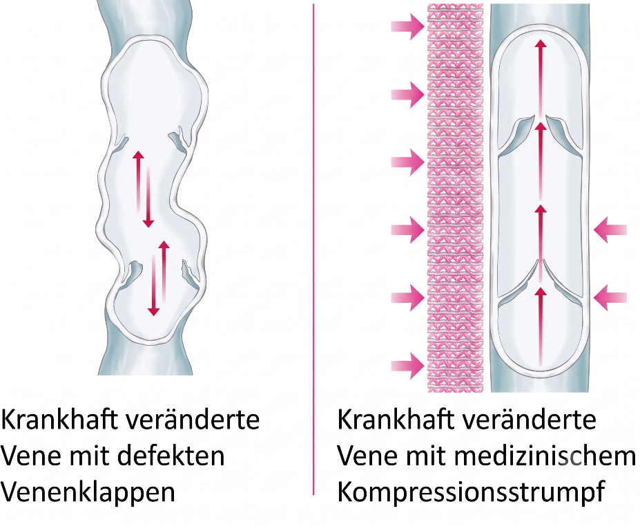 Venen-Grafik